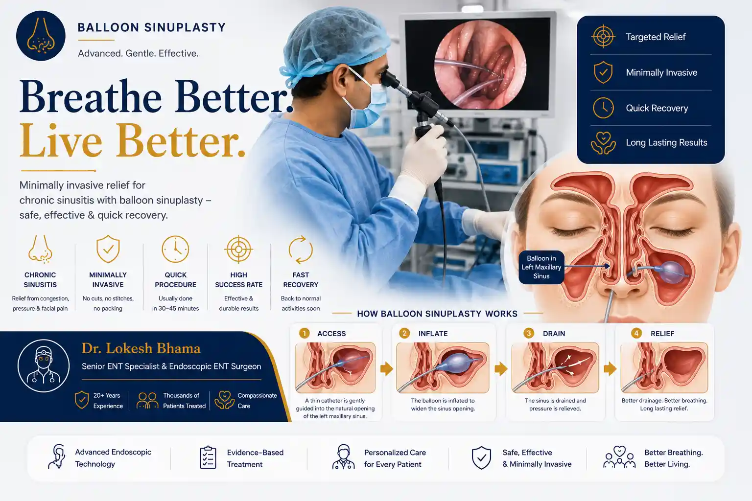 Balloon sinuplasty for selected sinus conditions