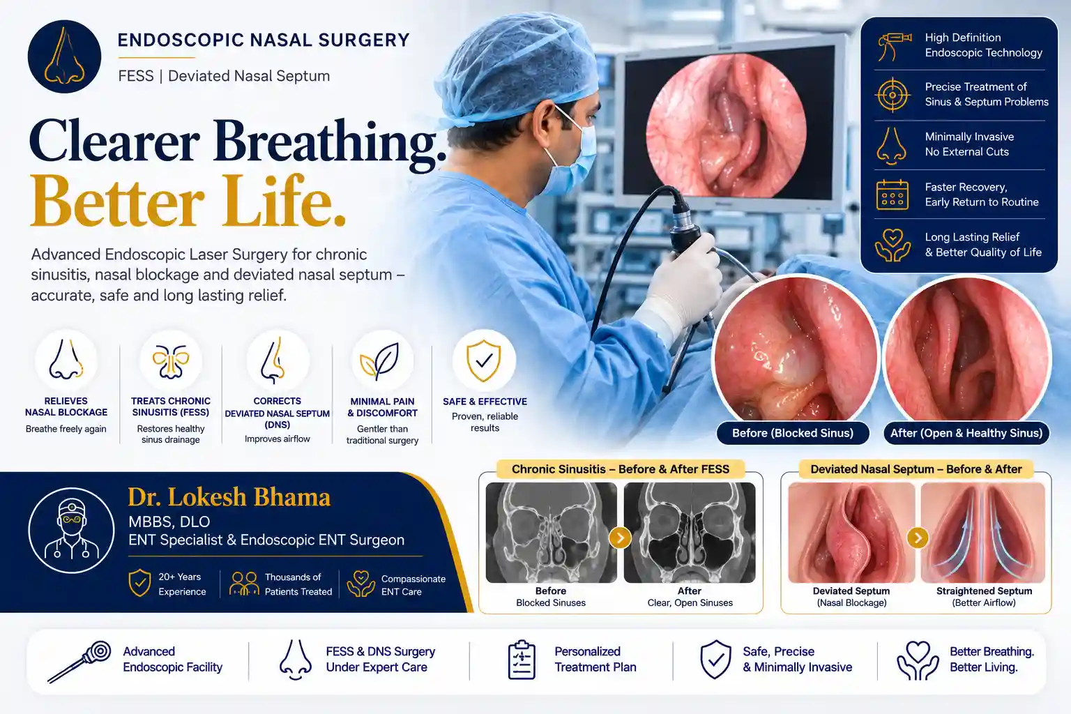Endoscopic sinus surgery and FESS for selected sinus conditions
